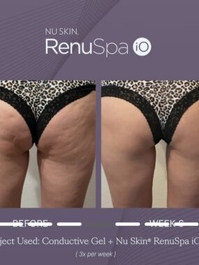 Nu Skin RenuSpa iO